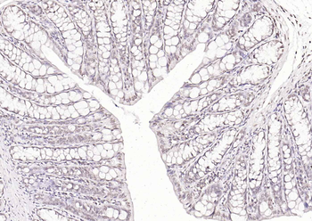 KLF12 antibody