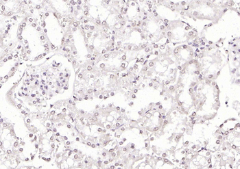 KLF12 antibody