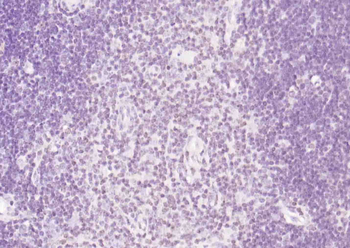 KAP1 (phospho-Ser473) antibody