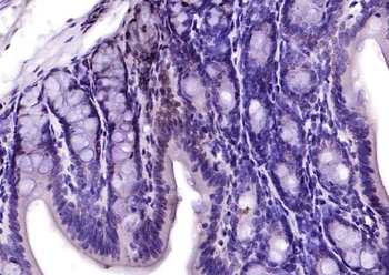 KAP1 (phospho-Ser473) antibody