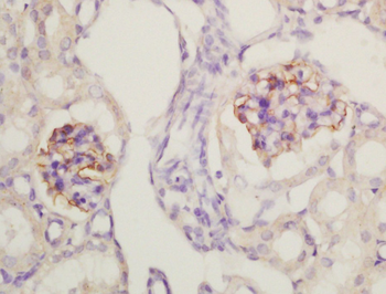 Nephrin antibody