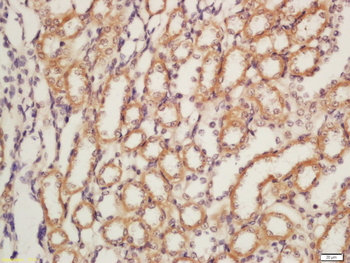 Nephrin antibody