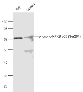 NFkB p65 (phospho-Ser281) antibody