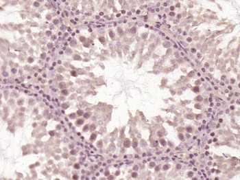 OTUD1 antibody