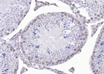 SBNO1 antibody