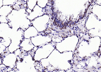 SBNO1 antibody