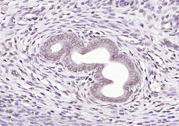 SBNO1 antibody