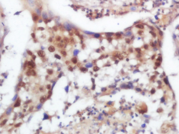 SOX9 antibody