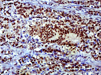 SOX9 antibody