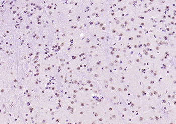 SOX9 antibody