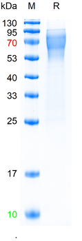 Recombinant human HAVCR1 protein, N-His (HEK293)