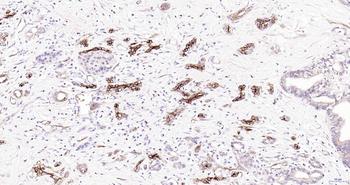 AQP1 Antibody