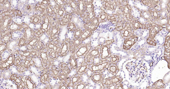 AQP1 Antibody