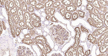 AQP1 Antibody