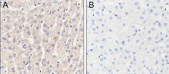 Lysine Antibody