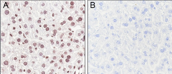 Lysine Antibody