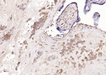 HLA-E Antibody