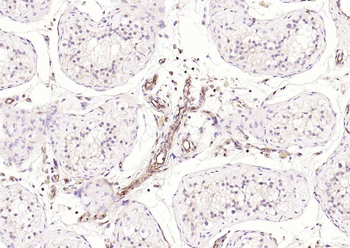 HLA-E Antibody