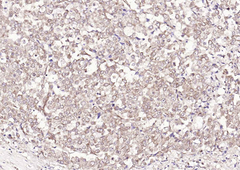 S100A1 Antibody