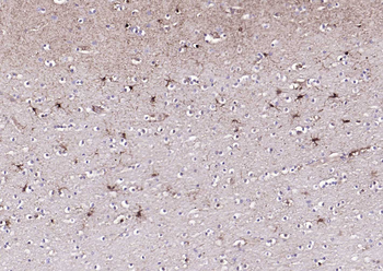 S100A1 Antibody