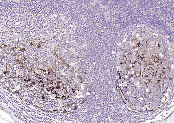 S100A1 Antibody