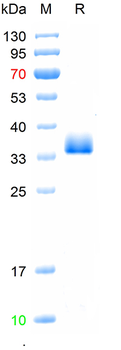 Recombinant SARS-Cov-2 Spike RBD protein (XBB.1/Omicron), His (HEK293)