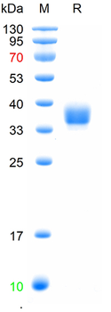 Recombinant SARS-Cov-2 Spike RBD protein (BF.7/Omicron), His (HEK293)