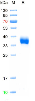 Recombinant SARS-Cov-2 Spike RBD protein (BQ.1.1/Omicron), His (HEK293)