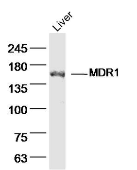 MDR1 Rabbit Polyclonal Antibody