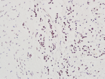 NARG1 Rabbit Polyclonal Antibody