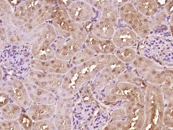 PKNOX1 Rabbit Polyclonal Antibody