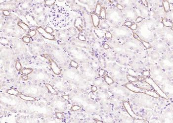 Angiotensin II Type 1 Receptor Rabbit Polyclonal Antibody