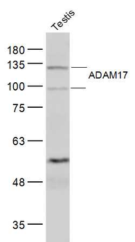 ADAM17 Rabbit Polyclonal Antibody
