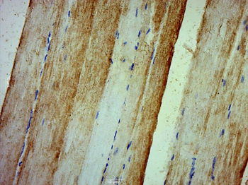 MYLPF Rabbit Polyclonal Antibody