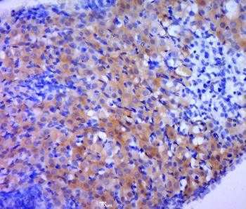 BCL2 (phospho-Thr129) antibody