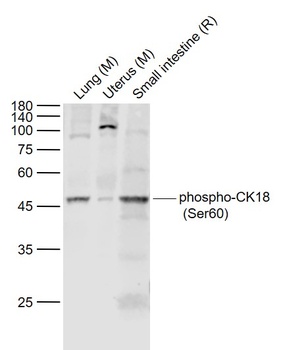 Cytokeratin 18 (phospho-Ser74) antibody