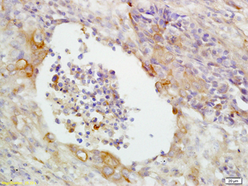 CD14 antibody