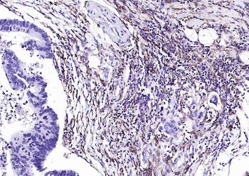 CD14 antibody