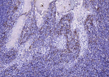 CD14 antibody