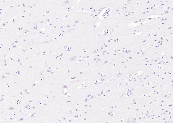CK18 Mouse Monoclonal Antibody