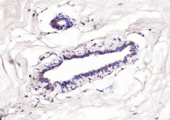 Bcl-2 antibody