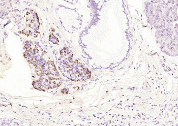 Bcl-2 antibody