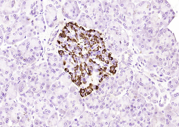 Bcl-2 antibody