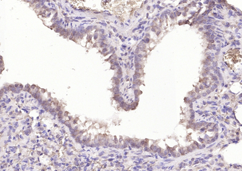 Bcl-2 antibody