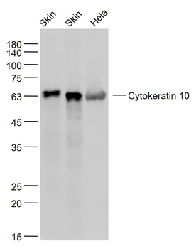 CK10 antibody