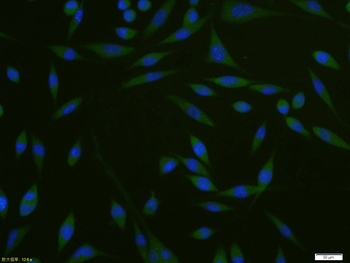 CK18 Recombinant Rabbit Monoclonal Antibody