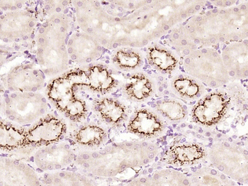 Cystatin-C Rabbit Polyclonal Antibody