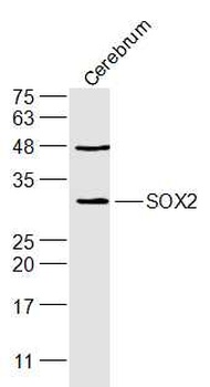 SOX2 antibody