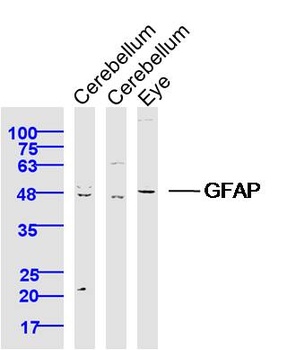 GFAP antibody