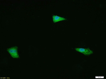 Phospho-ERK1/2 (Thr202 + Tyr204) Rabbit Polyclonal Antibody